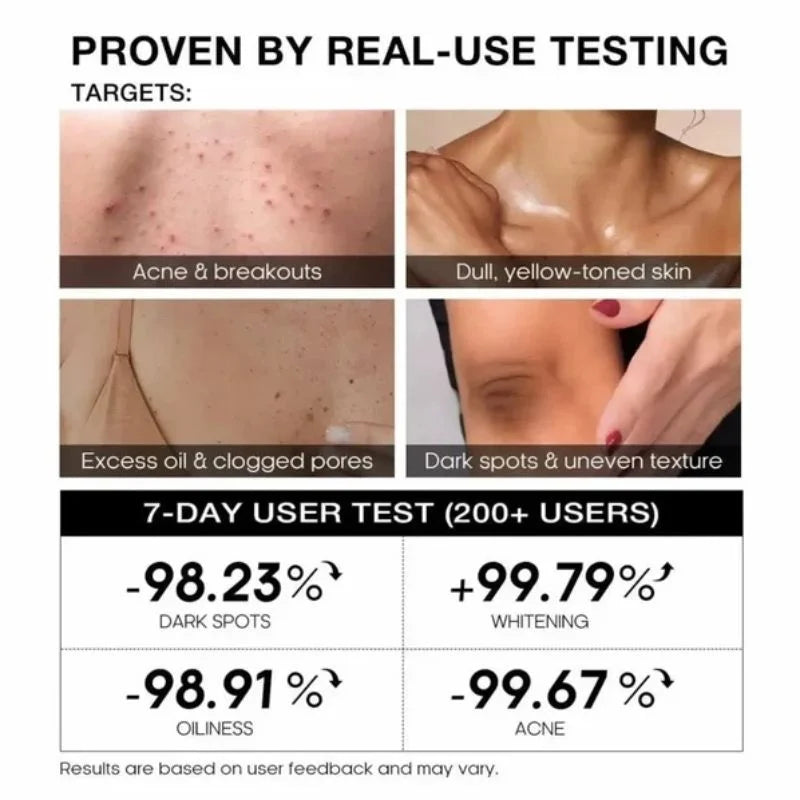 y8- TeaShell Niacinamide Skin Brightening Soap | Face & Body Brightening Bar with Niacinamide, Alpha Arbutin & Tranexamic Acid | Deep Cleansing Formula | For Men & Women | 100g