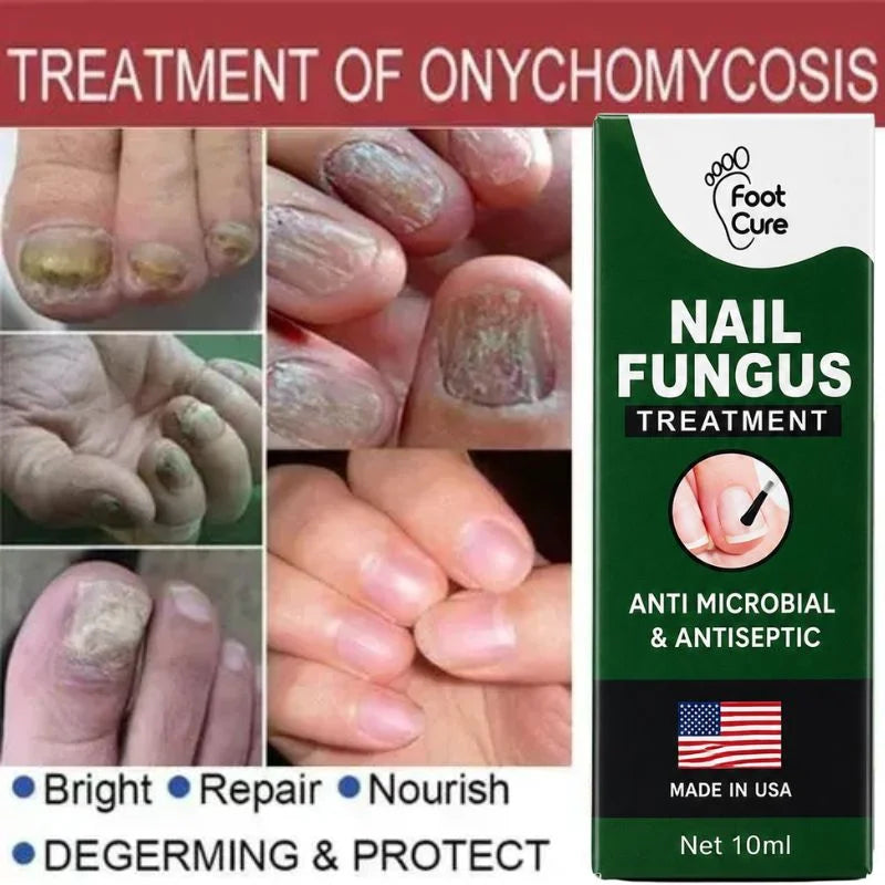 y28- Fast Nail Fungus Treatment Serum | Nail Repair Essence for Fingernails & Toenails | Natural Nail Care Formula