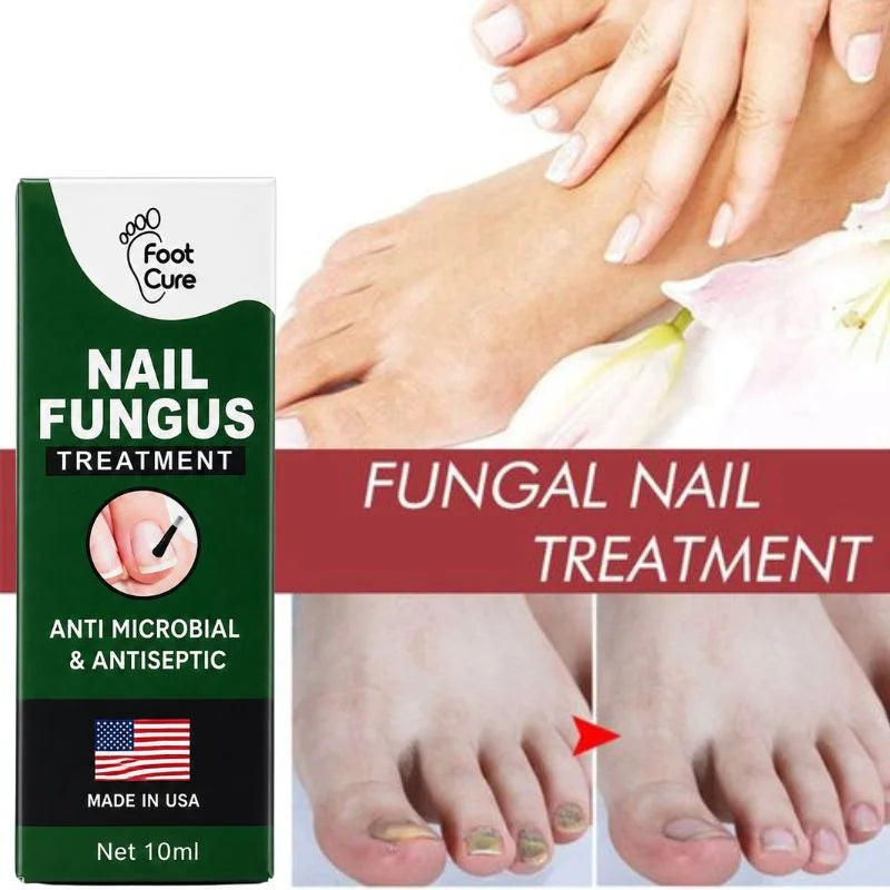 y28- Fast Nail Fungus Treatment Serum | Nail Repair Essence for Fingernails & Toenails | Natural Nail Care Formula