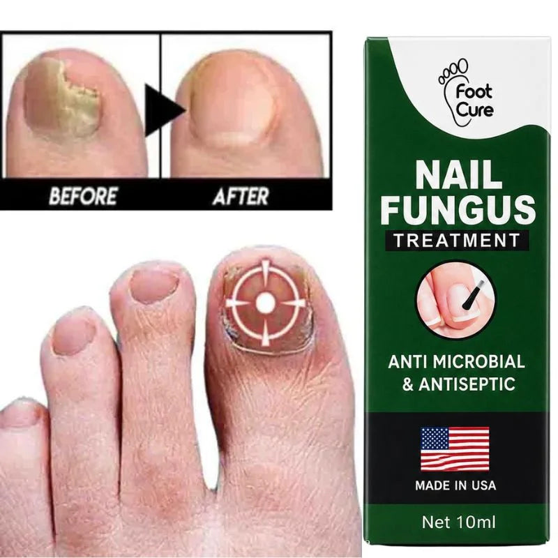 y28- Fast Nail Fungus Treatment Serum | Nail Repair Essence for Fingernails & Toenails | Natural Nail Care Formula