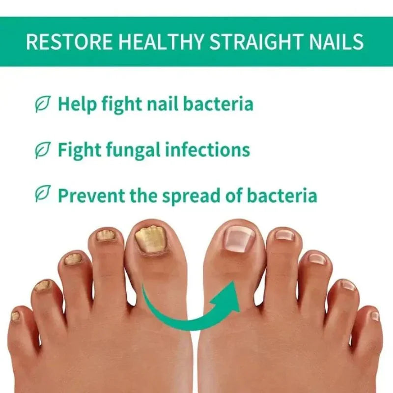 y28- Fast Nail Fungus Treatment Serum | Nail Repair Essence for Fingernails & Toenails | Natural Nail Care Formula