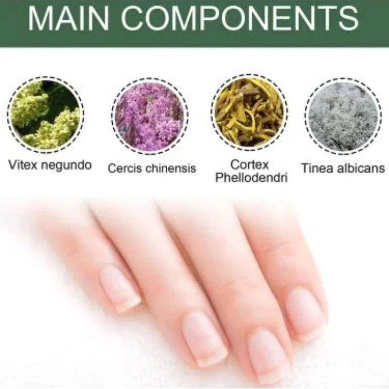 y28- Fast Nail Fungus Treatment Serum | Nail Repair Essence for Fingernails & Toenails | Natural Nail Care Formula