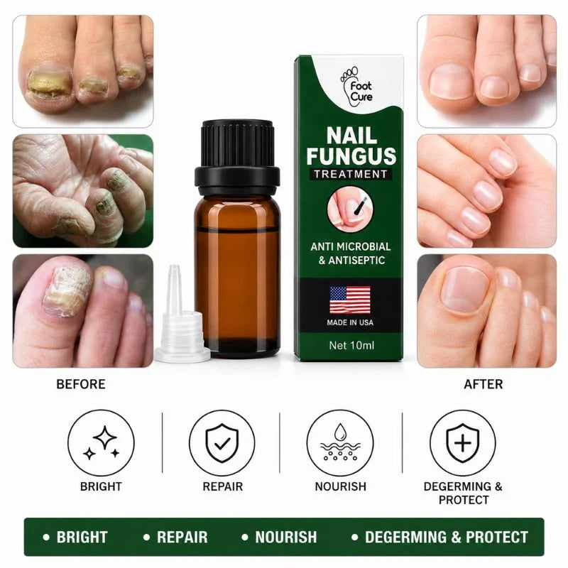 y28- Fast Nail Fungus Treatment Serum | Nail Repair Essence for Fingernails & Toenails | Natural Nail Care Formula