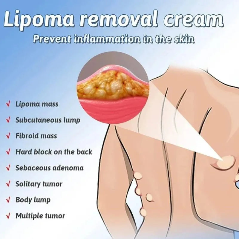 y13- Lipoma Removal  Cream | Herbal Skin Care Cream for Smooth & Nourished Skin | Fast-Absorbing Formula | For Neck & Body | 50g