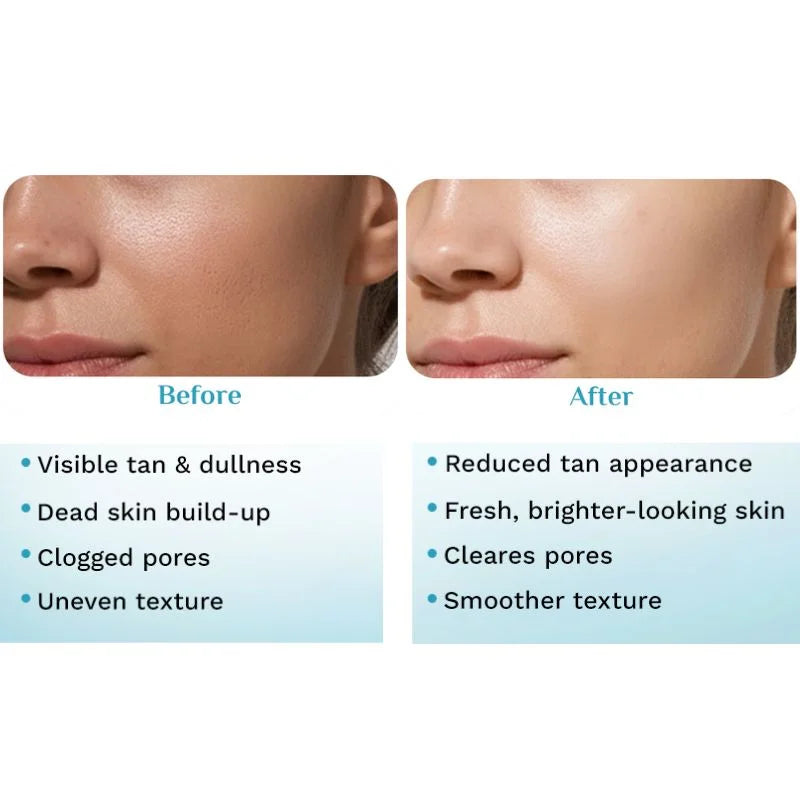 y10- Pilgrim Peeling Solution | Weekend Facial Peel for Deep Cleansing & Exfoliation | Radiant & Even-Toned Skin | For Men & Women | 30ml