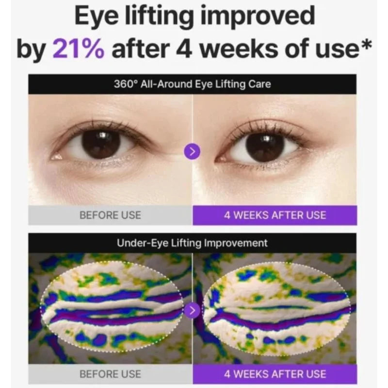 y6- Centellian24 360° Shot PDRN Lifting Eye Cream | Anti-Aging Eye Cream for Wrinkles, Puffiness & Dark Circles | Firming & Hydrating Formula | 30ml
