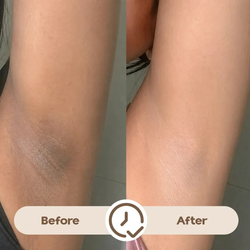 y4- Ray Time To Shine Underarm Serum | Brightening Underarm Serum with Niacinamide, Alpha Arbutin & Hyaluronic Acid | Lightweight Daily Care | 30ml